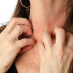 image of homeowner scratching skin and hvac and skin issues
